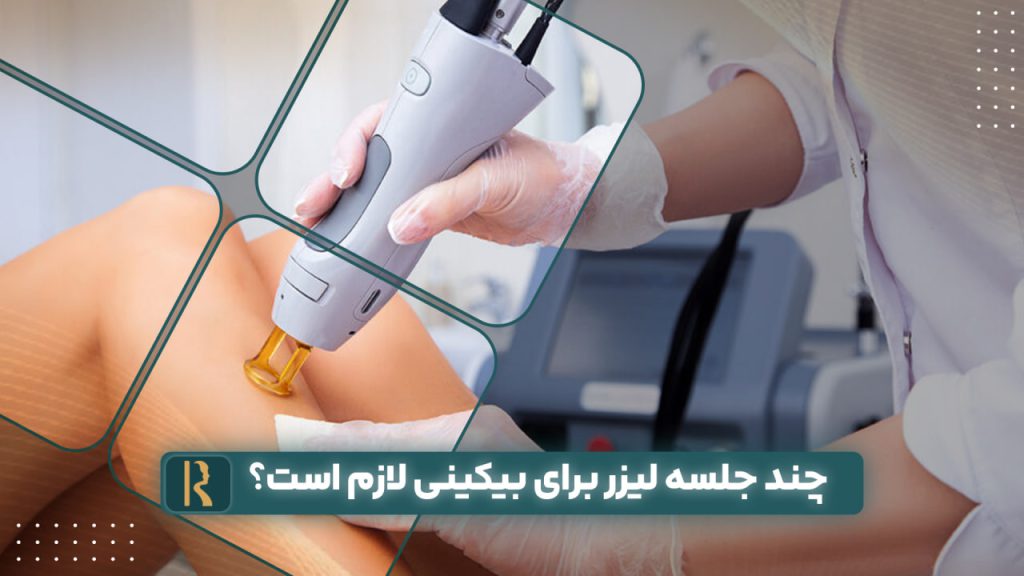 چند جلسه لیزر برای بیکینی لازم است؟