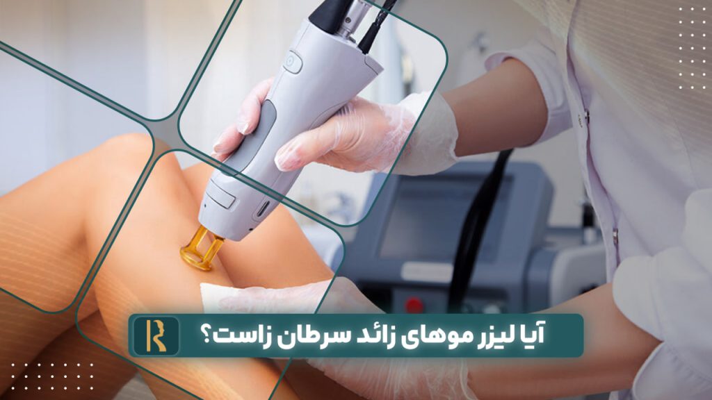 آیا لیزر موهای زائد سرطان زاست؟
