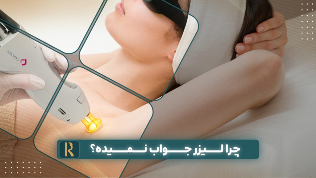 چرا لیزر جواب نمیده؟ یا دیر جواب میده؟ راه حل ها و بررسی دلایل آن