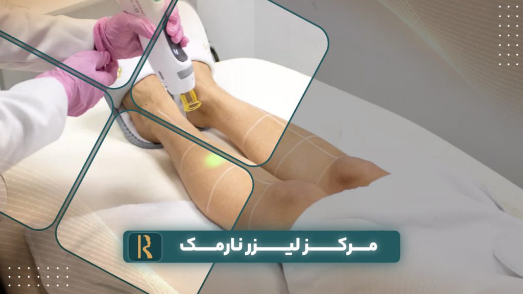 مرکز لیزر نارمک