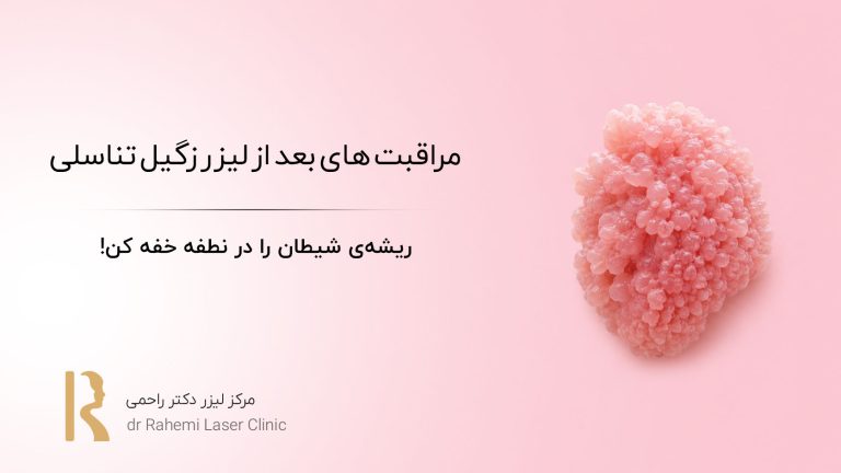 مراقبت های بعد از لیزر زگیل تناسلی: ریشهی شیطان را در نطفه خفه کن!